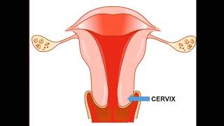 Cervical cancer -Dosage of HPV vaccination -Dr. Hema Divakar, senior  obGyn., Bangalore