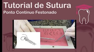 Ponto Contínuo Festonado - Tutorial de Sutura