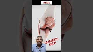 Knee joint