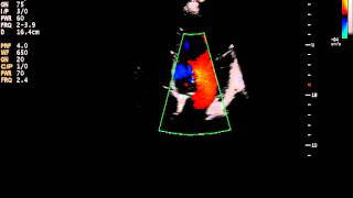 c23 cardiology ultrasound