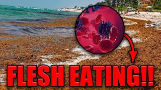 Why Is There FLESH EATING Bacteria On The Coast of Florida