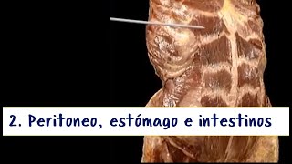 Cavidad abdominal - 2. Peritoneo, estómago e intestinos