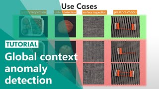 Global context anomaly detection by MVTec