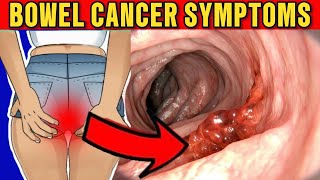 Colon Cancer Stage 4 Signs and Symptoms |  Nourish360