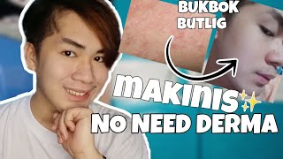 BUROG BUROG NA MUKHA PAANO KUMINIS AT PUMUTI?! NO NEED DERMA PARA MAGPAKINIS!!😱❤️