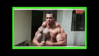 Bodybuilding: ce Brésilien voulait ressembler à Hulk, il a failli se faire amputer des bras