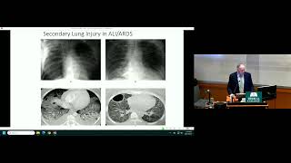 Perioperative Lung Protection: A View from the Last 40 Years