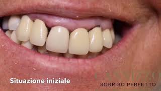 Implantologia dentale. Le tecniche migliori