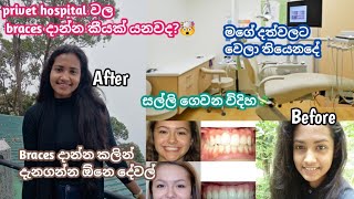 privet hospital එකකින් braces දාන්න කීයක් යනවද ?🤯braces දාන්න කලින් දැනගෙන ඉන්න ඕනෙ දේවල් #braces