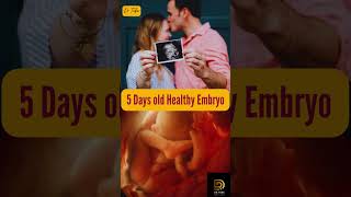 27 Weeks 5 Days old Healthy Embryo is developing in his moms womb and the mother is watching him👶