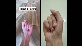 I have 4 fingers