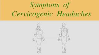 Cervicogenic Headache Clinical Pattern