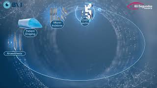 Cataract Pathway Video