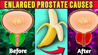 Warning! These 5 Foods Causes Enlarged Prostate - Shrink Enlarged Prostate