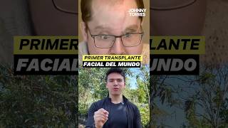 Así fue el primer trasplante facial del mundo con resultado exitoso