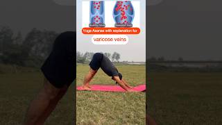 Yoga asana for varicose veins at home #asana #yogaposes #treatment #ytshorts