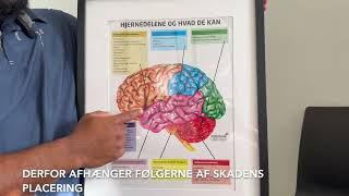 Neuroklinikken - Gener efter hjerneblødning eller blodprop