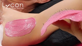 Underarm Wax Using 'Fool Proof' LYCOdream Hot Wax | LYCON Cosmetics