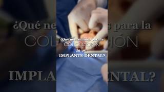 IMPLANTE DENTAL