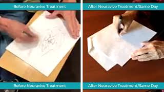 MR-Guided Focused Ultrasound - Patient Pre and Post Treatment