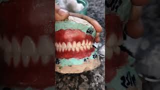 full denture dant kaise banate Hain