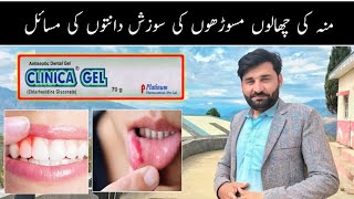 clinica Gel uses benefit | how to uses clinica Gel | chlorhexidine gluconate uses | clinica uses