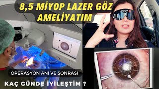 LAZER GÖZ AMELİYATI İLE GÖZLÜĞE SON | ÖNCESİ - SONRASI | NO TOUCH SMİLE LAZER | OPERASYON ANI 👁👨‍⚕️