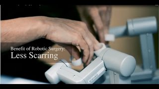 The Benefits of Robotic Hysterectomy Surgery - Less Scarring