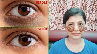 How to Remove Dark Circles|চোখের তলায় কালি কীভাবে Remove করবে। Remove Puffy Eyes/Wrinkles/Fine lines