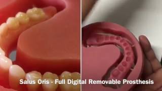 Full digital denture