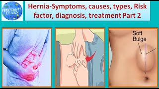 Hernia Symptoms, causes, types, Risk factor, diagnosis, treatment Part 2