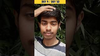 #shorts #ytshort Day 9/Day 30