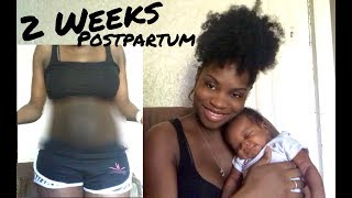 2 Weeks Postpartum| Meeting Baby| Belly Shot| A. Wood