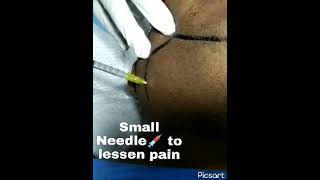 Small Needle to lessen pain #Shorts