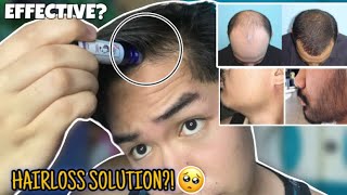 SOLUTION SA MANINIPIS ANG BUHOK (hairlines,kilay,balbas)✨ EFFECTIVE PAMPAKAPAL!❤️