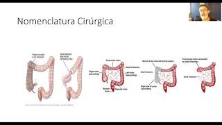 Nomenclatura Cirúrgica