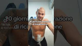 20 giorni post operazione di ricanalizzazione.