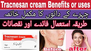 how to use tretinoin cream | tracnesan cream review | acne treatment | tretinoin cream