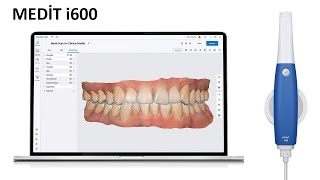 MEDiT i600 Dijital Diş Hekimliği Parmaklarınızın Ucunda