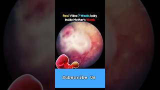 #prebirth #womb #newborn #fetalmovement #fetus #weekspregnant #shortsvideo #trendingvideo #labtech