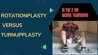 Rotationplasty versus Femorotibial turnup plasty : Modified Amputation Surgery for Bone Tumors