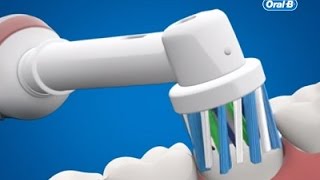 Oral-B | Elektrische Tandenborstels Zijn Veilig Voor Het Tandvlees