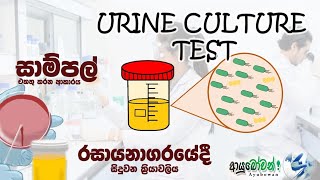 Urine Culture test එක ගැන සියලුම දේ දැන ගන්න