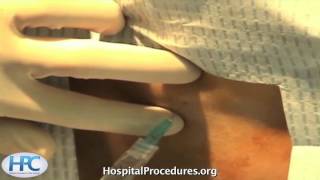 Lumbar Puncture Video Trailer