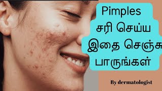 Dermatologist tips to manage acne/ pimples from home/ acne removal/ home remedies/acne cure