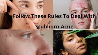 How these Tips for Acne might help, and You Will Be Surprised!