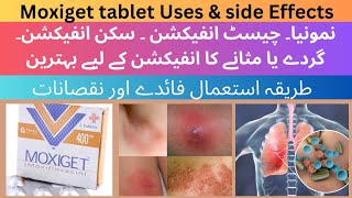 Moxiget 400 Mg Uses in Urdu | Moxiget Moxifloxacin 400 Mg/Moxifloxacin tab Benefits or uses........