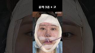 얼굴형으로 어려보이는 효과👌#plasticsurgeryinkorea