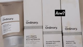 The ordinary products ||Azelaic Acid||Ascorbyl Glucoside ||Hyaluronic acid ||Rose hip seed oil