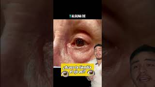 Te tiembla el ojo? #shortvideo